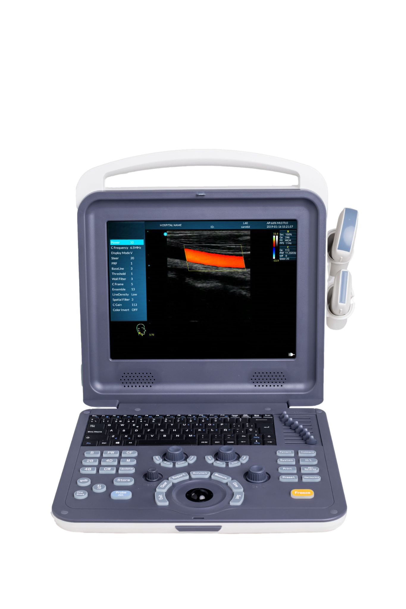 Portable Color Doppler Ultrasound Scanner TPCD-6