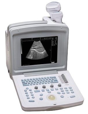 Portable B/W Ultrasound Scanner  TPU-180